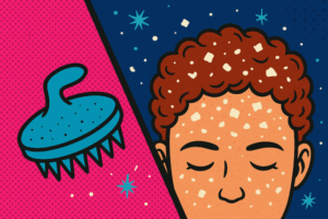 How To Get Rid Of Dandruff: Healthy Scalp Solutions